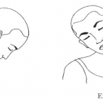 et1et2 mov cuello